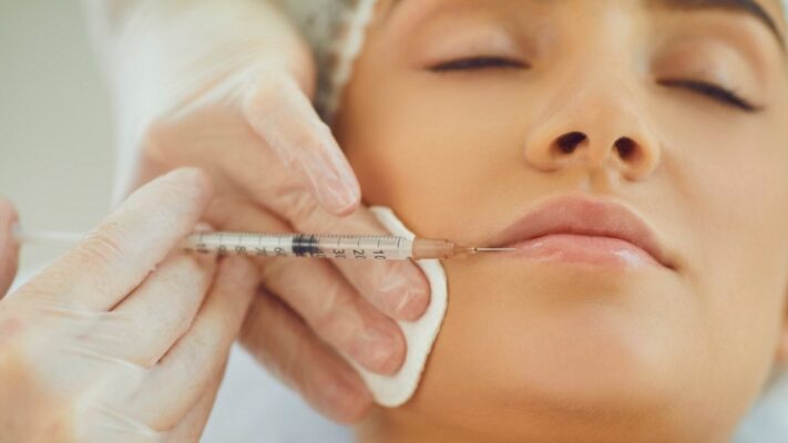 Độn cằm rồi có tiêm filler được không
