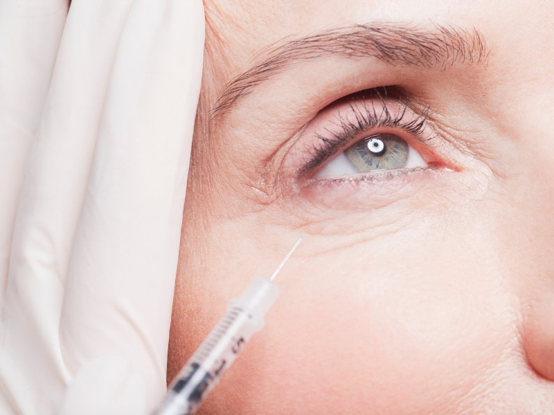 Giải đáp thắc mắc tiêm botox bao lâu có tác dụng, ta biết khoảng 24-72 giờ sau tiêm sẽ cảm nhận được sự thay đổi trên da