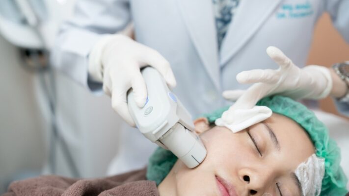 phương pháp Ultherapy là gì