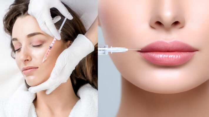Tiêm Botox và Filler Khác Gì Nhau