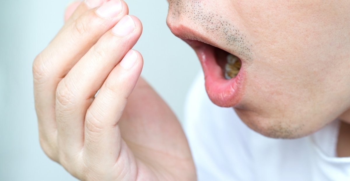 Trị hôi miệng bằng lá chanh