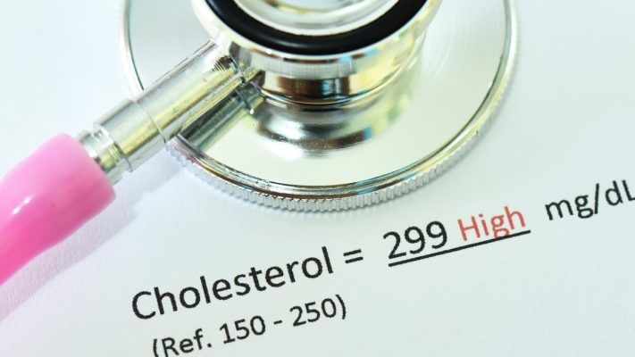 Cholesterol cao nên ăn gì? Gợi ý thực phẩm tốt cho tim mạch
