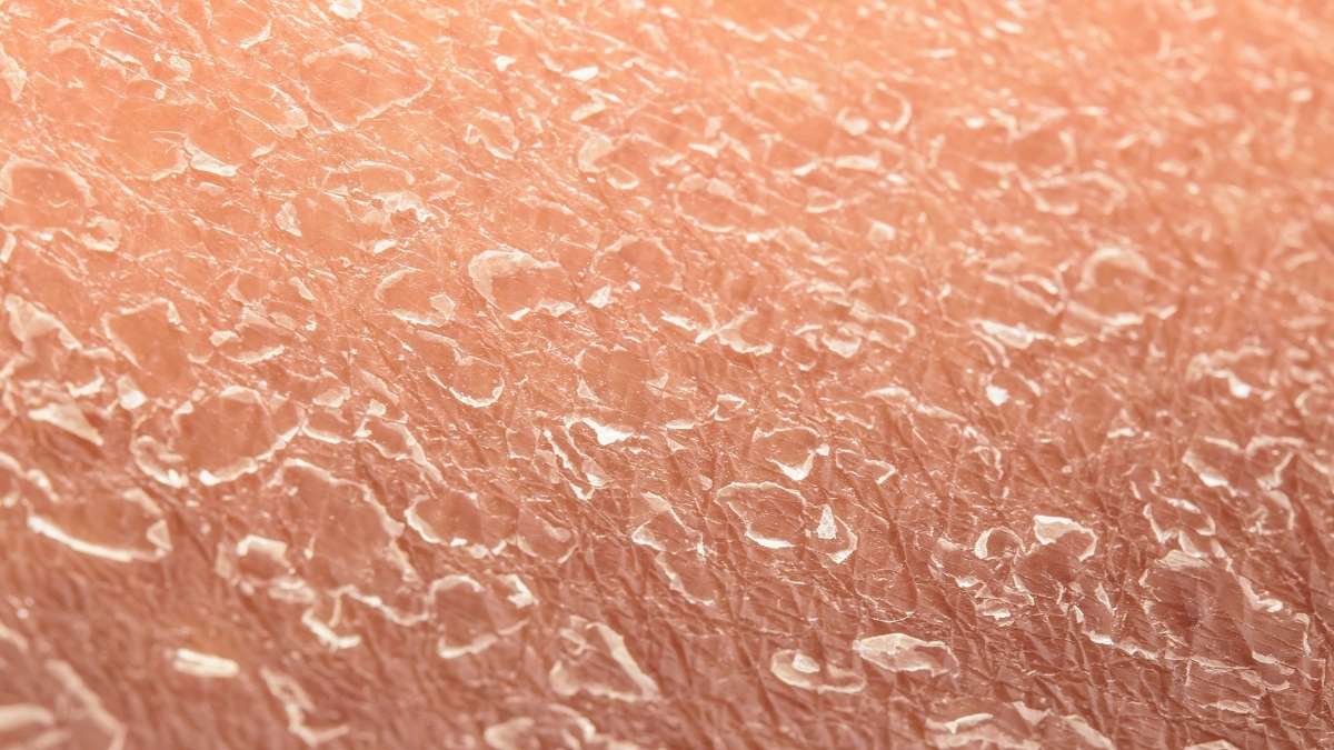 Mất nước là gì? Hiểu rõ tác hại khi tế bào mất nước