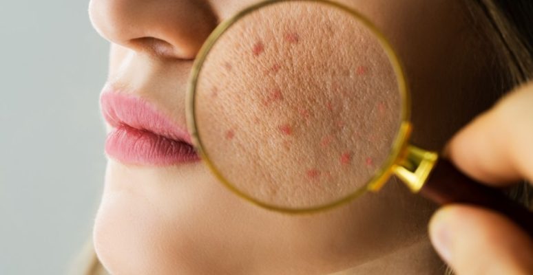 Hàng rào bảo vệ da là gì